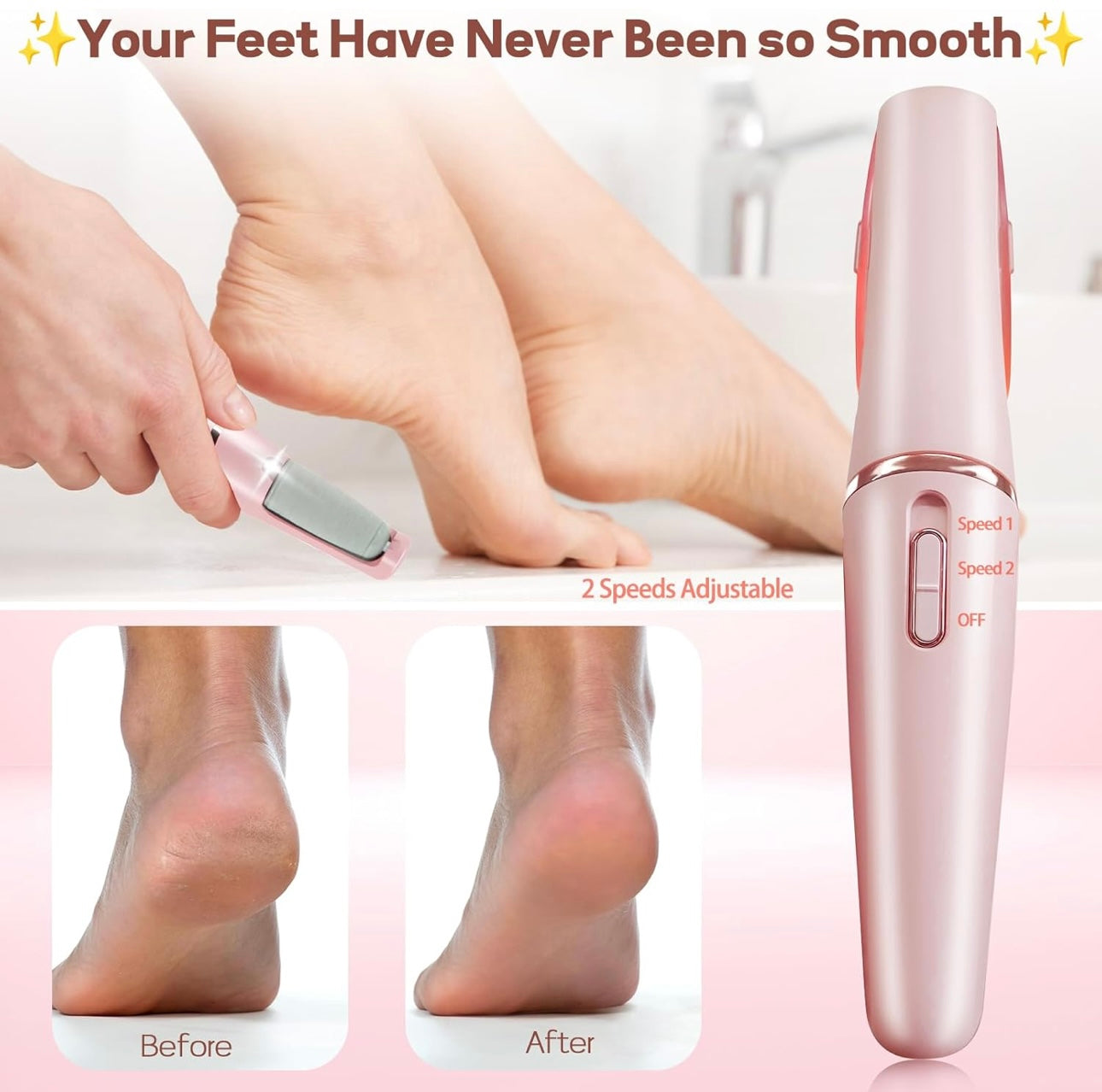 Electronic Callus Remover – Safe, Smooth, Salon-Style Pedicure at Home