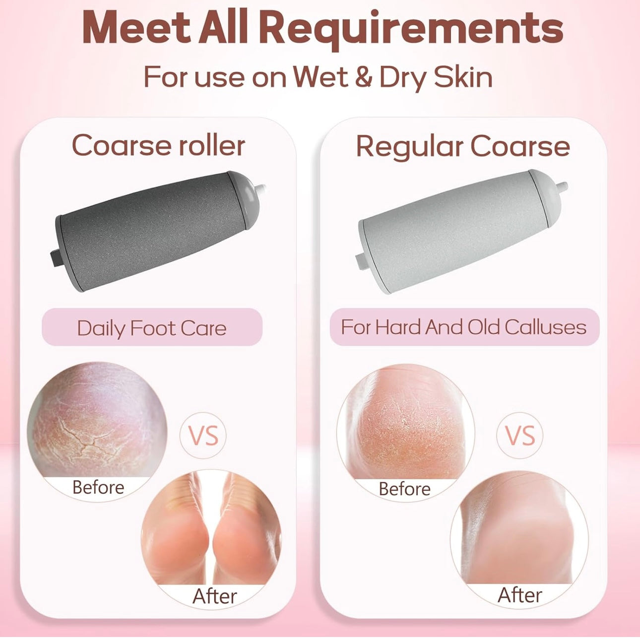 Electronic Callus Remover – Safe, Smooth, Salon-Style Pedicure at Home